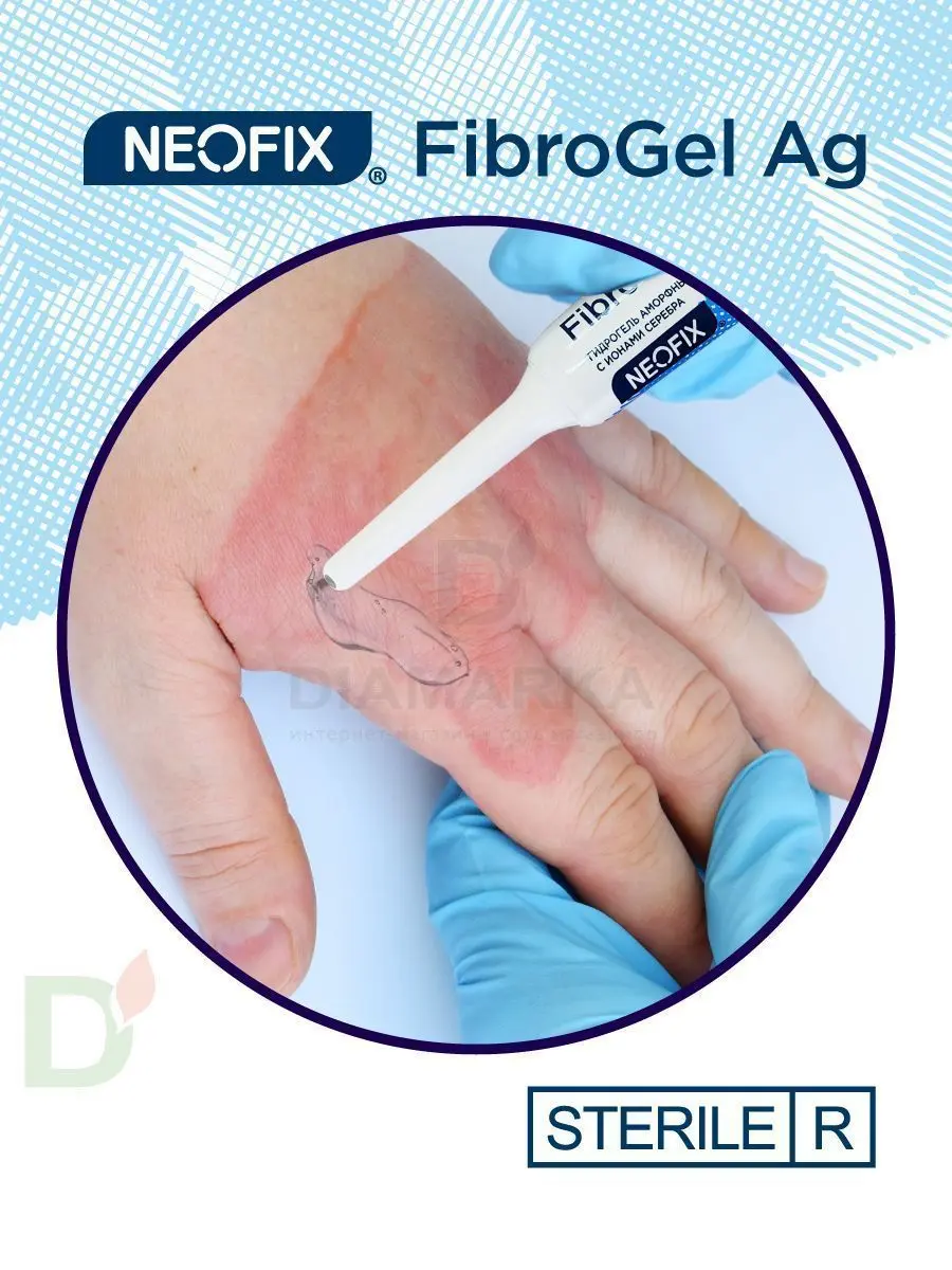 Гидрогель антимикробный NEOFIX FibroGel Fg с ионами серебра 15г в Красноярске